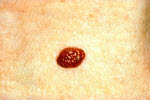 Lunar normal 2